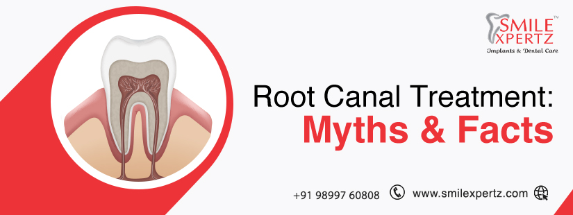 Root Canal Treatment Myths Facts