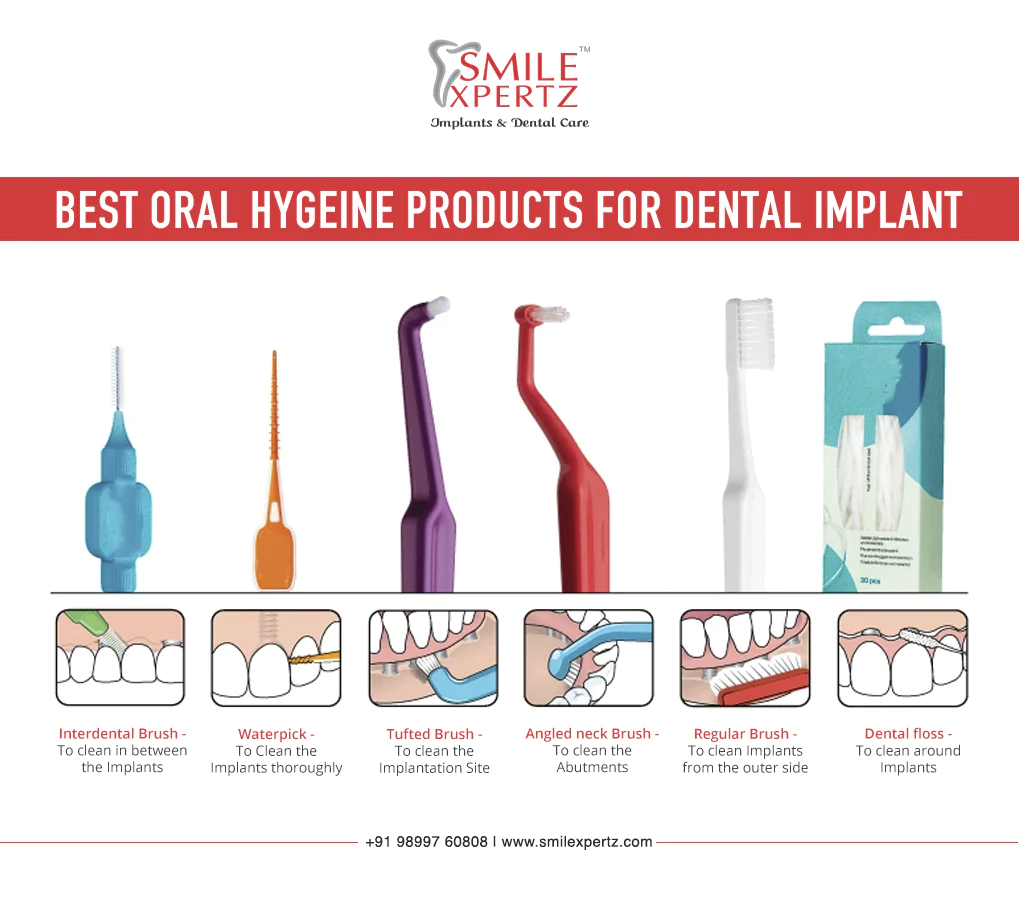 HOW TO KEEP YOUR DENTAL IMPLANT CLEAN HYGIENIC