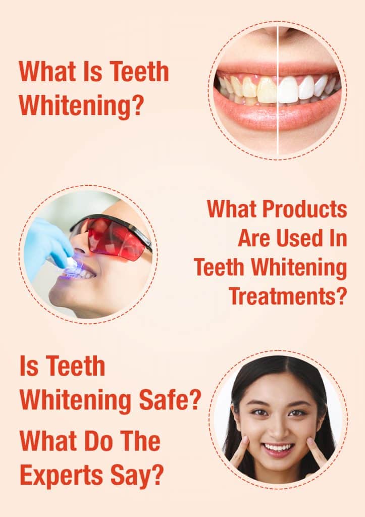 Is Teeth Whitening In Gurgaon Safe Smile Xpertz